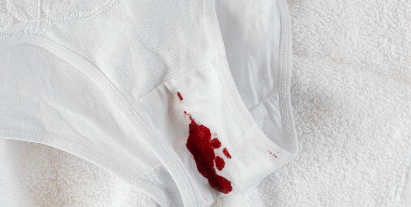 Parpadeo puerta otoño 6 tips para eliminar manchas de menstruación en tu ropa | Estilo Musa  Estilo De Vida