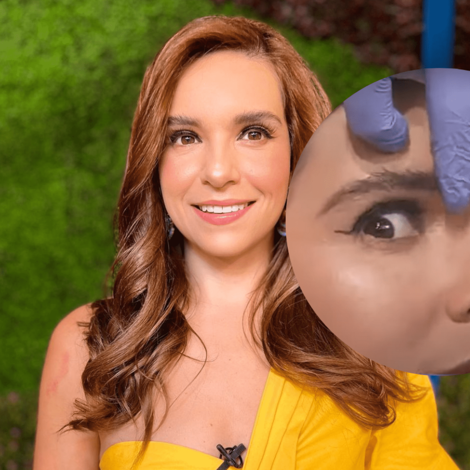Tania Rincón se pone baby botox en pleno programa en vivo; este es el  resultado | Estilo Musa Celebridades