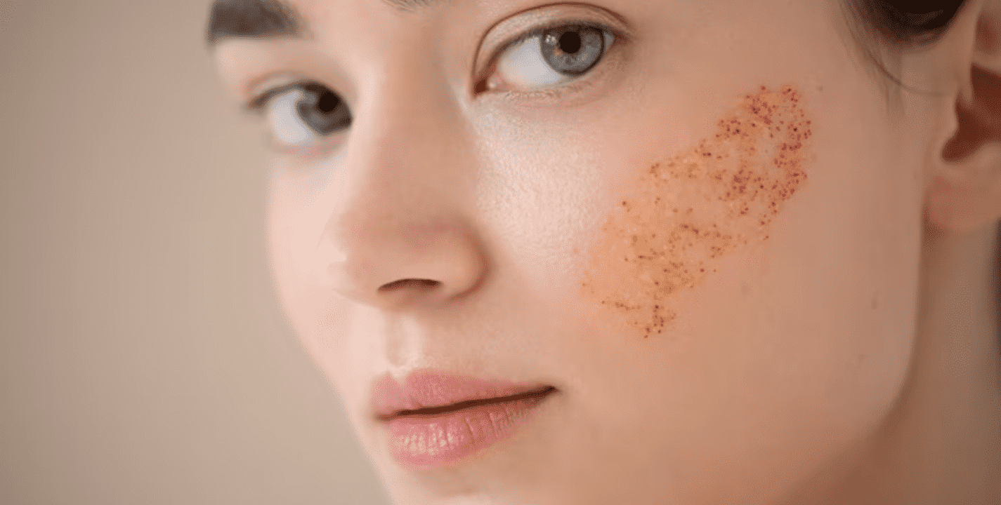 5 Cosas que pueden manchar tu piel y no sabías, según un experto en dermatología